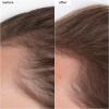 Briogeo Destined For Density MegaStrength+ Caffeine + Biotin Peptide Density Serum, Increases Hair Thickness and Volume, Fast-Absorbing & Non-Greasy, Fragrance-Free, Vegan, Cruelty-Free, 1.5 fl oz