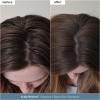 Briogeo Scalp Revival Scalp Care Essentials Set | Detox & Hydrate Your Scalp with Charcoal- + Tea Tree-Infused Treatments | Vegan & Cruelty Free