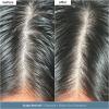 Briogeo Scalp Revival Scalp Care Essentials Set | Detox & Hydrate Your Scalp with Charcoal- + Tea Tree-Infused Treatments | Vegan & Cruelty Free